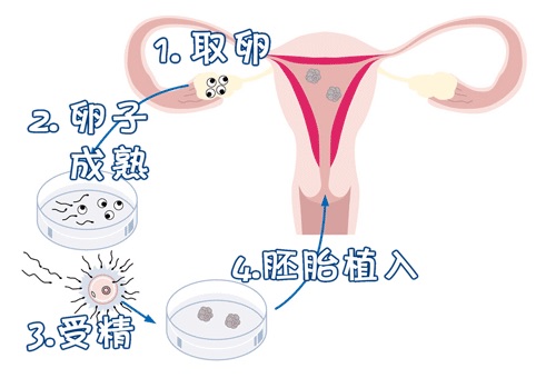 冷冻室